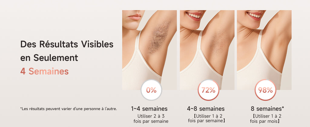 Résultat Épilateur lumière pulsée